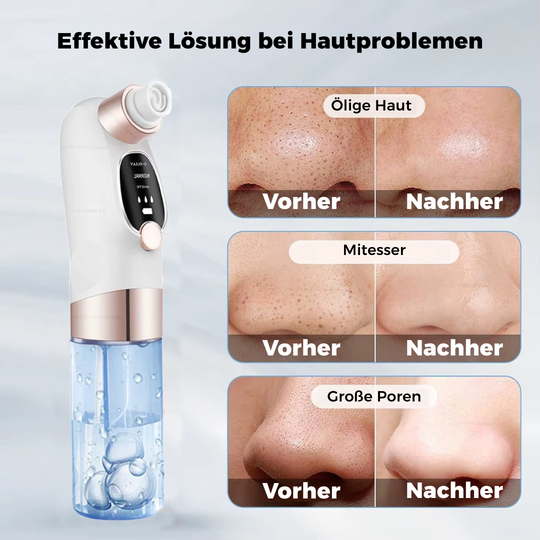 Puriti - PROFESSIONEL SKIN CARE